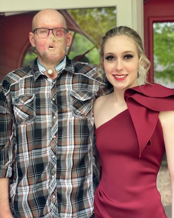 Aaron James, pictured here with his daughter Allie, after his injury and before the operation.