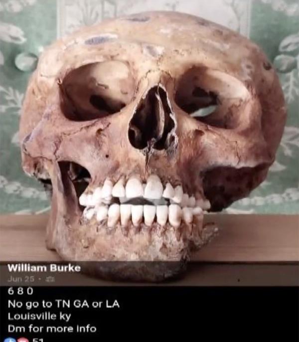 Human skull 