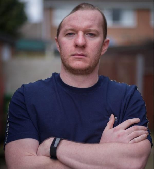 FILE PICTURE - Braden Stromberg, of Clipstone, Nottinghamshire, who lost half his skull after a vicious assault by Kyle Stephenson in Bolsover. See SWNS story SWLNskull. A man who was left with half of his skull missing following a brutal assault is enjoying a new lease of life after havin<em></em>g his head rebuilt - out of plastic. Braden Stromberg, 27, almost died after he was punched to the ground during a sickening attack on May 2 last year. He was left with a bleed on the brain and spent 15 days in a coma after being assaulted from behind by thug Kyle Stephenson in Bolsover, Derbys. Doctors had to remove the right side of his skull before he went on to make a miracle recovery which stunned medics at the time. But his life was put on hold after he was forced to wear a helmet to shield his unprotected brain and lived in fear a single knock to the head could kill him. Following a wait of over a year, Braden has now undergone pio<em></em>neering surgery to reco<em></em>nstruct his head shape using a polycarbo<em></em>nate moulded to the shape of his skull. The grounds worker says he's looking forward to returning to work and leading a normal life again following mo<em></em>nths of being at risk of death just doing day-to-day activities.